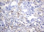 VIM Antibody in Immunohistochemistry (Paraffin) (IHC (P))