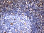 VIM Antibody in Immunohistochemistry (Paraffin) (IHC (P))