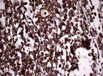 VIM Antibody in Immunohistochemistry (Paraffin) (IHC (P))