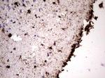 VIM Antibody in Immunohistochemistry (Paraffin) (IHC (P))