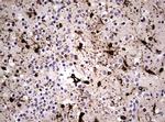 VIM Antibody in Immunohistochemistry (Paraffin) (IHC (P))