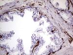 VIM Antibody in Immunohistochemistry (Paraffin) (IHC (P))