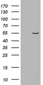 VIM Antibody in Western Blot (WB)