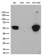 VIM Antibody in Western Blot (WB)