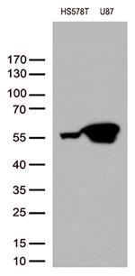 VIM Antibody in Western Blot (WB)
