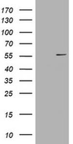 VIM Antibody in Western Blot (WB)