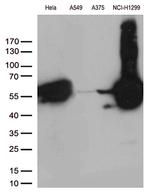 VIM Antibody in Western Blot (WB)