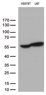 VIM Antibody in Western Blot (WB)