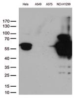 VIM Antibody in Western Blot (WB)