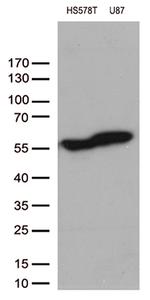 VIM Antibody in Western Blot (WB)
