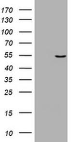 VIM Antibody in Western Blot (WB)