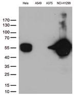 VIM Antibody in Western Blot (WB)