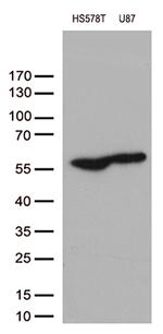VIM Antibody in Western Blot (WB)