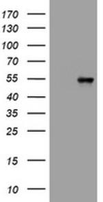 VIM Antibody in Western Blot (WB)