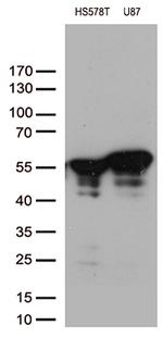 VIM Antibody in Western Blot (WB)