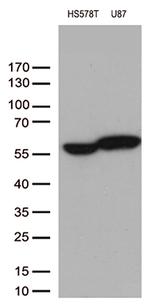 VIM Antibody in Western Blot (WB)