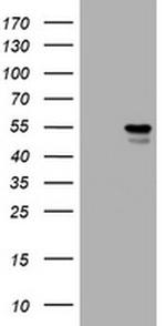 VIM Antibody in Western Blot (WB)