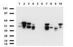 VIM Antibody in Western Blot (WB)