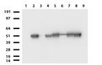 VIM Antibody in Western Blot (WB)