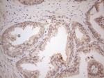 VIP Antibody in Immunohistochemistry (Paraffin) (IHC (P))