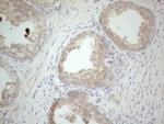 VIP Antibody in Immunohistochemistry (Paraffin) (IHC (P))