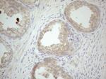 VIP Antibody in Immunohistochemistry (Paraffin) (IHC (P))