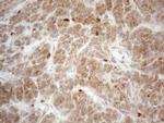VIP Antibody in Immunohistochemistry (Paraffin) (IHC (P))