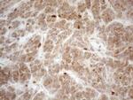 VIP Antibody in Immunohistochemistry (Paraffin) (IHC (P))