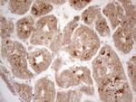 VIP Antibody in Immunohistochemistry (Paraffin) (IHC (P))
