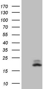VIP Antibody in Western Blot (WB)