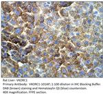 VKORC1 Polyclonal Antibody