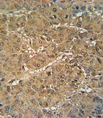 VKORC1 Antibody in Immunohistochemistry (IHC)