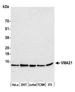 VMA21 Polyclonal Antibody