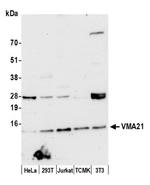 VMA21 Polyclonal Antibody