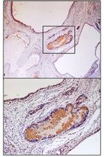 VMAT2 Polyclonal Antibody