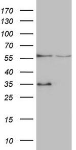 VPS13B Antibody in Western Blot (WB)