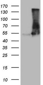 VPS13B Antibody in Western Blot (WB)