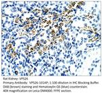 VPS26 Polyclonal Antibody