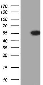 VRK2 Antibody in Western Blot (WB)
