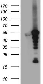 VRK2 Antibody in Western Blot (WB)