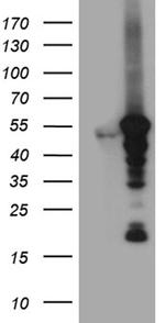 VRK2 Antibody in Western Blot (WB)