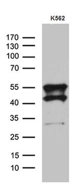 VRK2 Antibody in Western Blot (WB)