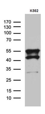 VRK2 Antibody in Western Blot (WB)