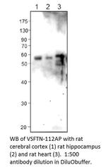 Visfatin Polyclonal Antibody