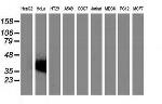 VSIG2 Antibody in Western Blot (WB)