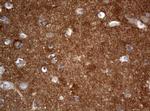 VSNL1 Antibody in Immunohistochemistry (Paraffin) (IHC (P))