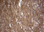 VSNL1 Antibody in Immunohistochemistry (Paraffin) (IHC (P))