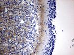 VSNL1 Antibody in Immunohistochemistry (Paraffin) (IHC (P))