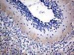 VSNL1 Antibody in Immunohistochemistry (Paraffin) (IHC (P))