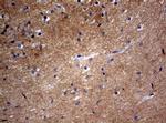 VSNL1 Antibody in Immunohistochemistry (Paraffin) (IHC (P))